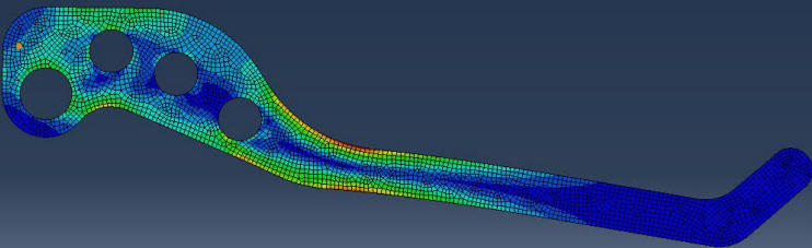 Von Mises stress result for the motorcycle brake lever finite element model